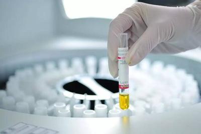 中國IVD試劑臨床使用現狀與挑戰 基于診斷技術研發視角的分析